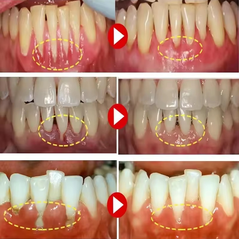 Gel Blanqueador Dental, Repara - Teeth Whitening Toothpaste reseña y precio