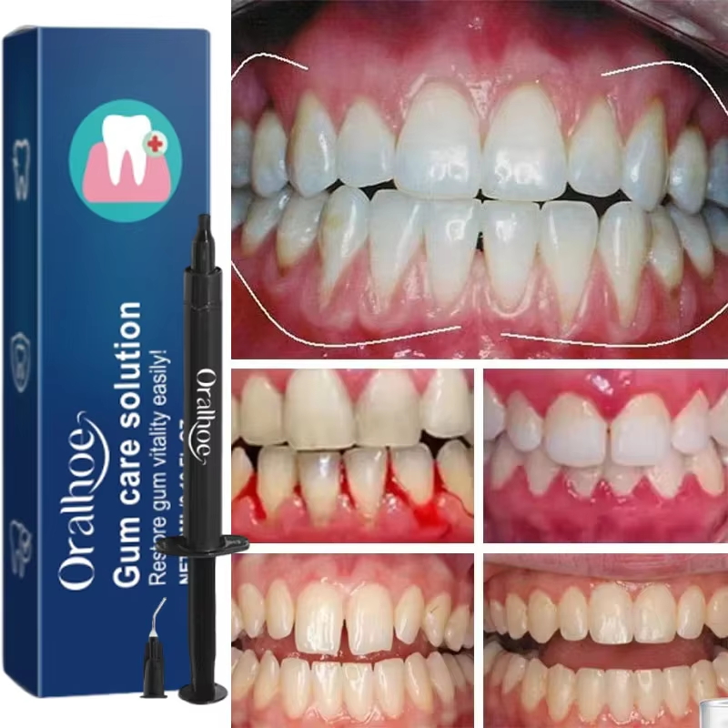 Gel Blanqueador Dental, Repara - Teeth Whitening Toothpaste reseña y precio
