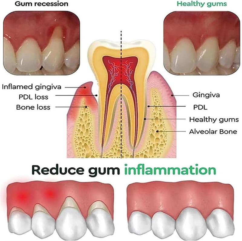 Gel Blanqueador Dental, Repara - Teeth Whitening Toothpaste reseña y precio