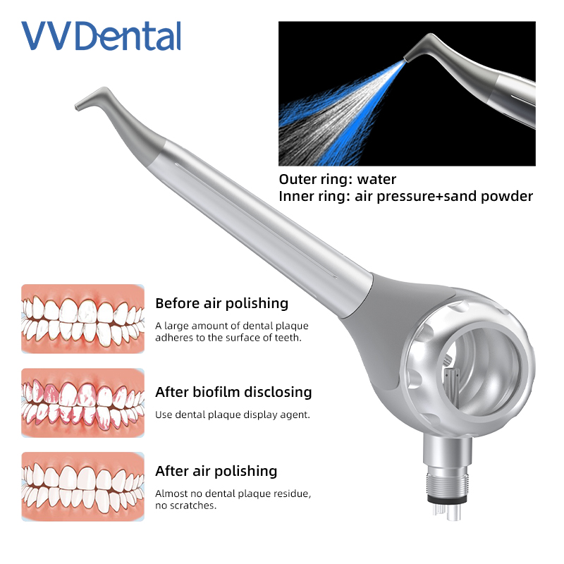 Pistola de arenado dental VV d - Teeth Whitening Usa reseña y precio