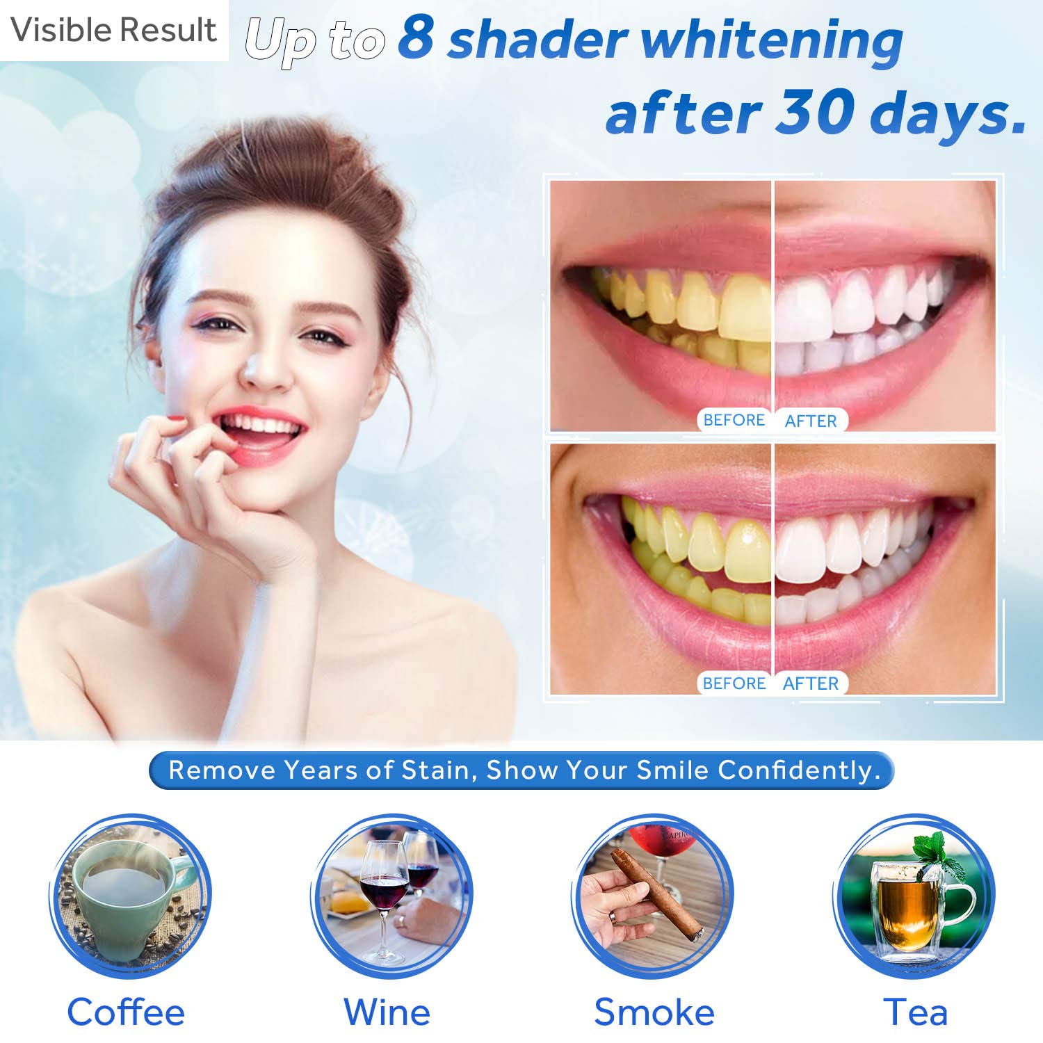 Jeringa de repuesto de Gel par - Teeth Whitening With Trays reseña y precio