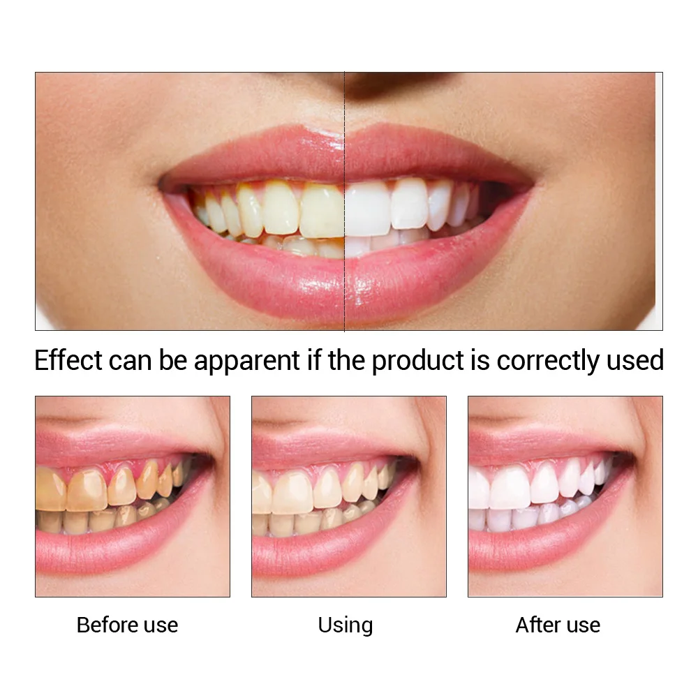 FTEENPLY-esencia para blanquea - Teeth Paint Whitening reseña y precio