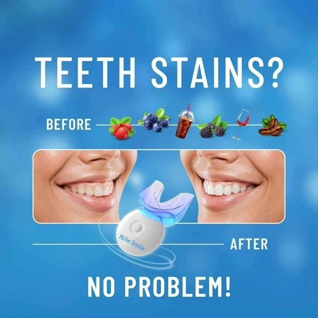 Kit de Blanqueamiento Dental I - Teeth Whitening At Home Kit reseña y precio