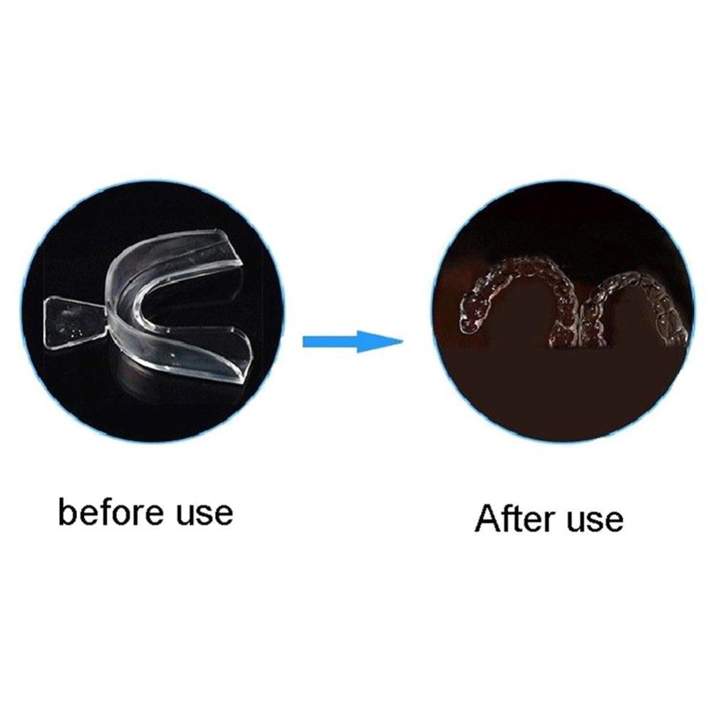 Protector Bucal de Silicona, R - Teeth Whitening With Trays reseña y precio