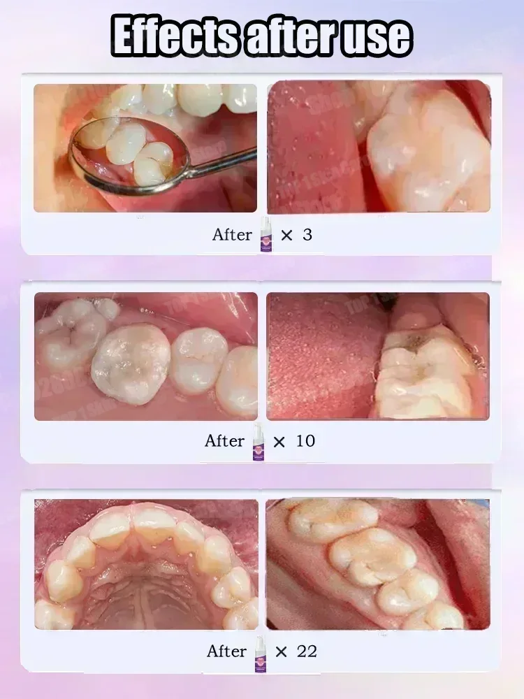 Ventas calientes Más vendido,  - Teeth Whitening Toothpaste reseña y precio