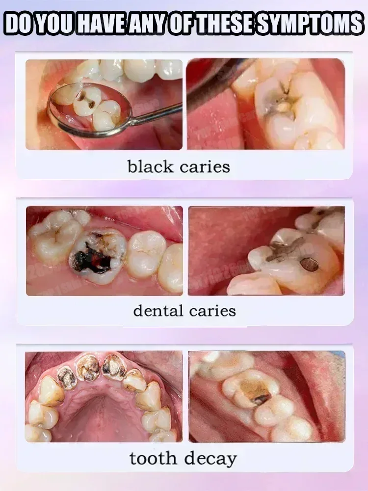 Ventas calientes Más vendido,  - Teeth Whitening Toothpaste reseña y precio