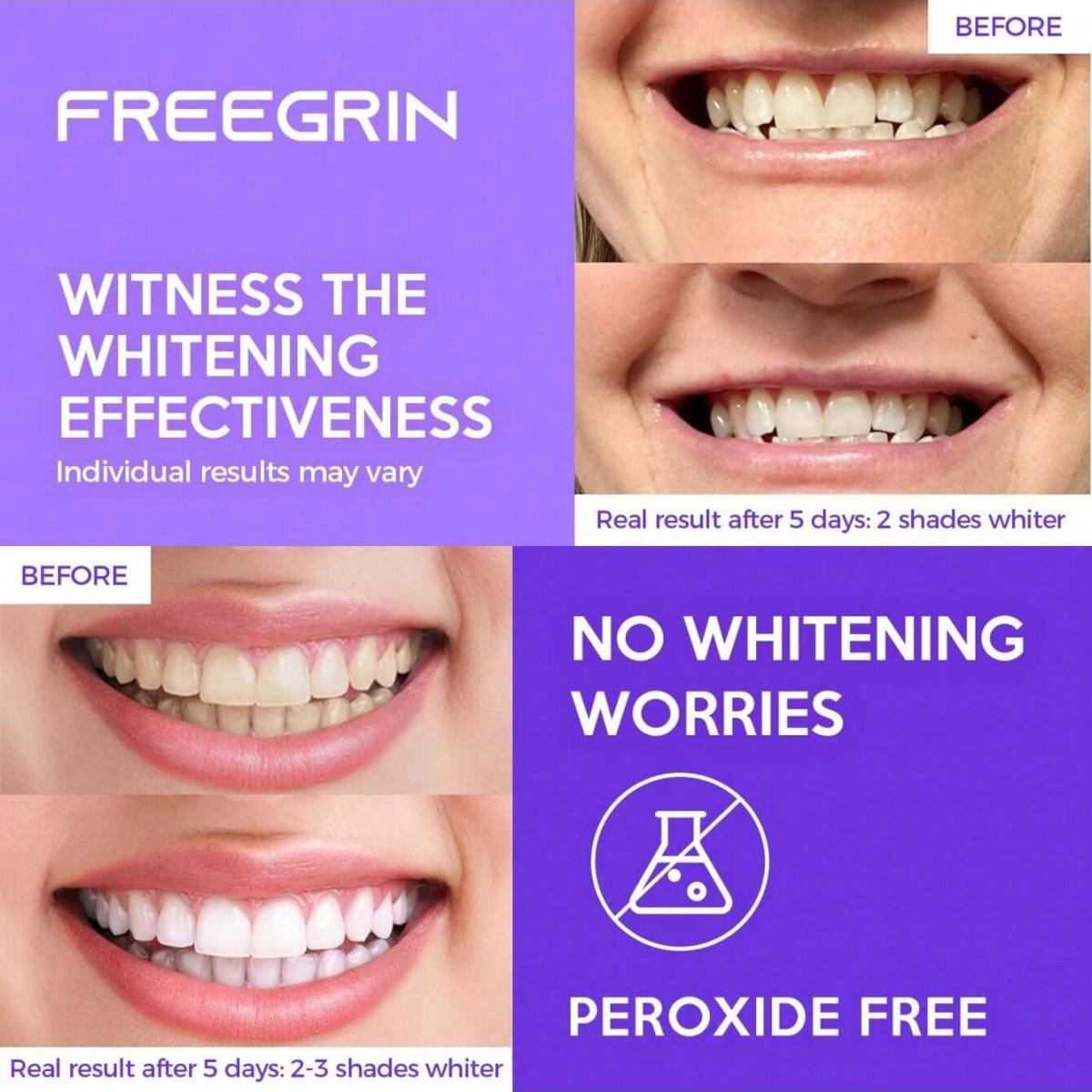 Pegatinas blanqueadoras de die - Teeth Whitening Gels Used By Dentists reseña y precio