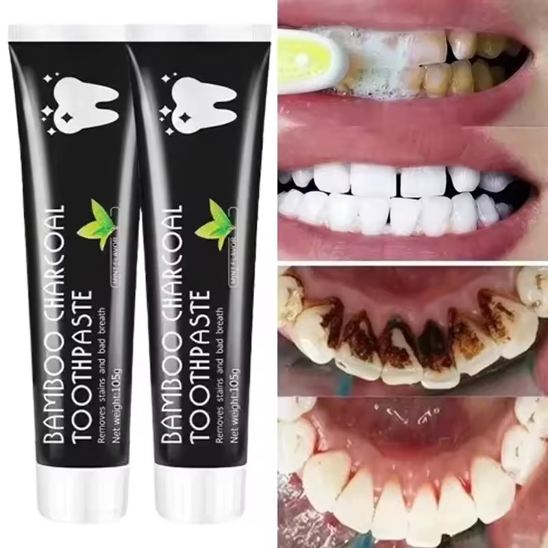 Pasta Dental Blanqueadora de C - Teeth Whitening Charcoal reseña y precio